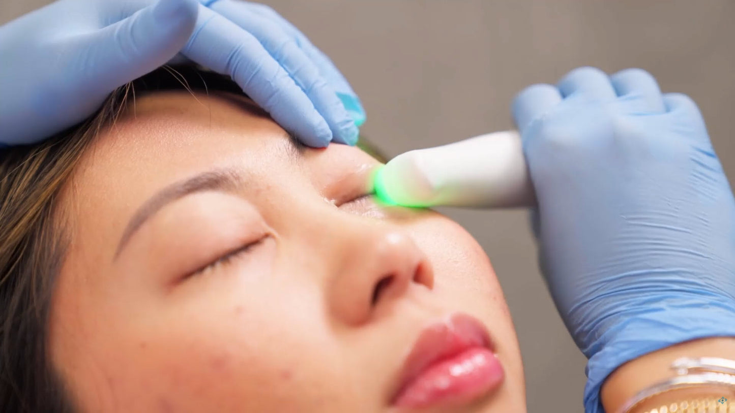 NuLIDS PROcedure Refill Packs (20 Treatments)